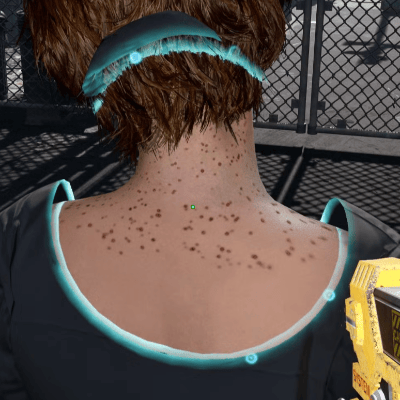 Skin rash